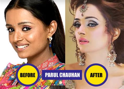 top 10 plastic surgery of popular tv actress before and after boom indya