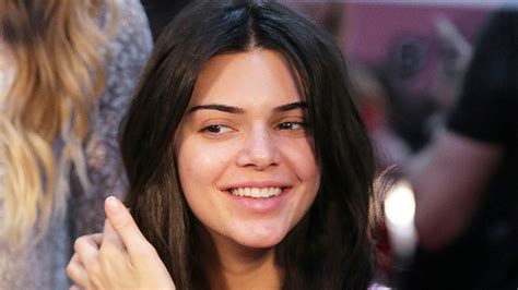 how to treat stress acne like kendall jenner