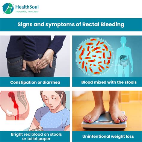 rectal bleeding causes and treatment gastroenterology