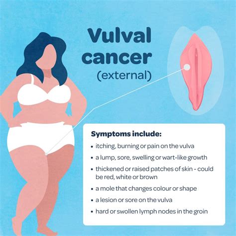 What Is Gynaecological Cancer And What Are The Symptoms
