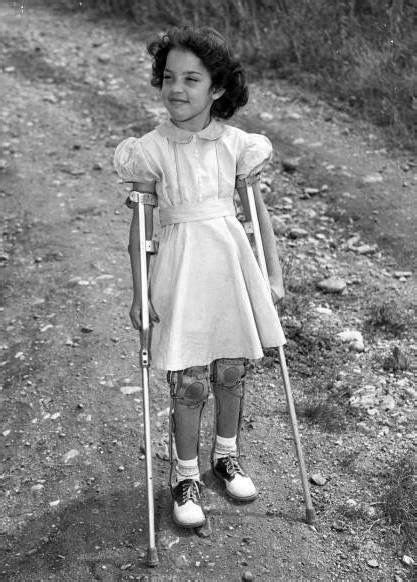 pin by dianne dych on polio 3 braces legs