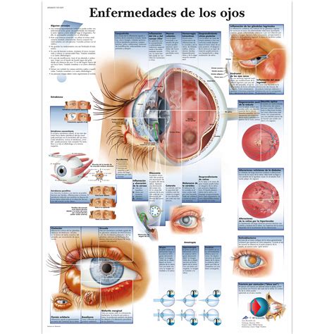 enfermedades de los ojos  vrl ophthalmology  scientific
