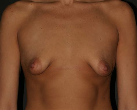 flat saggy tit breast shapes image 4 fap