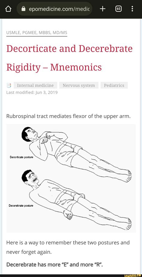 usmle pgmee mbbs decorticate  decerebrate rigidity