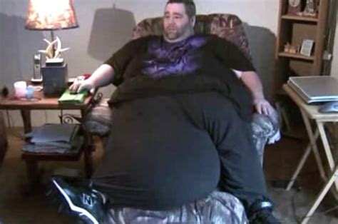 Man With Testicle Weighing Over 100lbs Raises Money For Operation