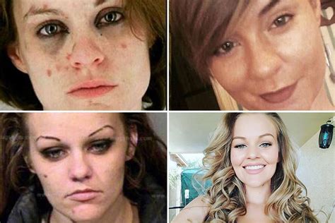 former drug addicts share incredible transformation photos which show