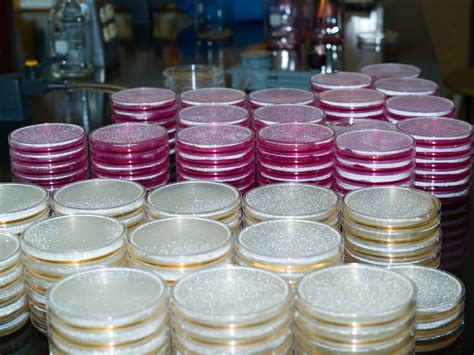 photo petri plates microorganism lab laboratory   jooinn