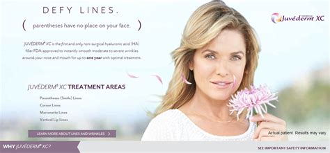 What Is JuvÉderm® Xc Juvederm Botox Smile Lines