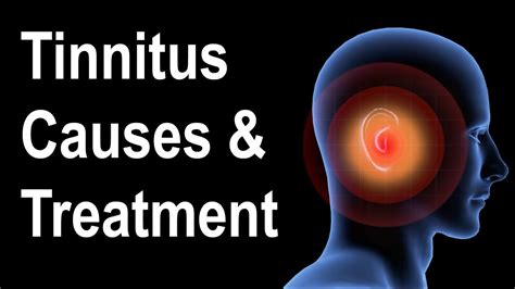 tinnitus treatment understanding tinnitus health reign