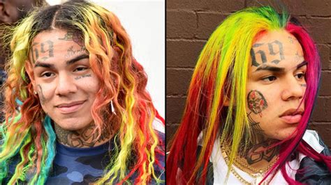 Tekashi 6ix9ine May Have To Remove His Face Tattoos To Go