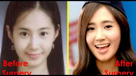Snsd Before And After Plastic Surgery 2014 Ranked Official Hd Youtube