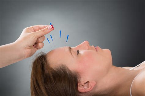 acupuncture helpful  acute preventive treatment  migraine