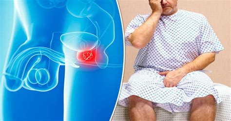 10 warning signs of prostate cancer daily star