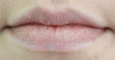 7 things your lips are trying to tell you about your health