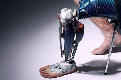 The Alternative Limb Project Bespoke Prosthetic Limbs