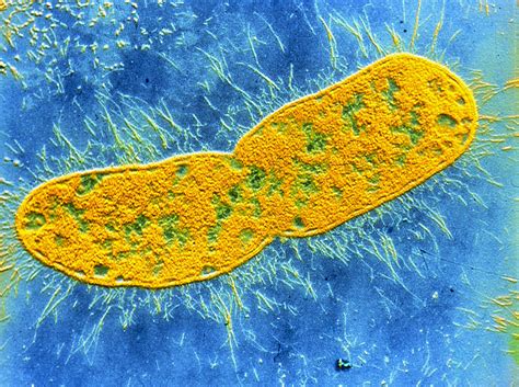 klebsiella pneumoniae bacterium photograph  cnri