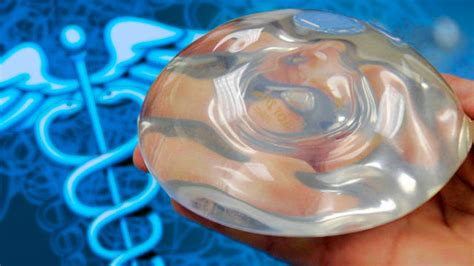 these are the risks of breast implants according to a surgeon fox news
