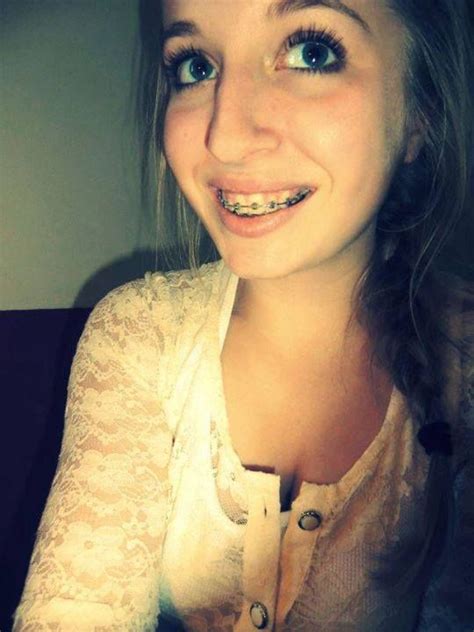 116 best images about girls with braces d on pinterest