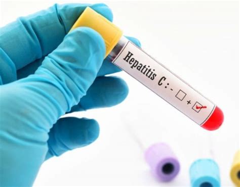 ¿cómo se contagia la hepatitis c