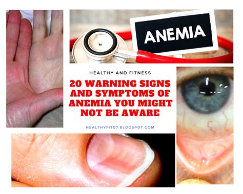 warning signs  symptoms  anemia     aware