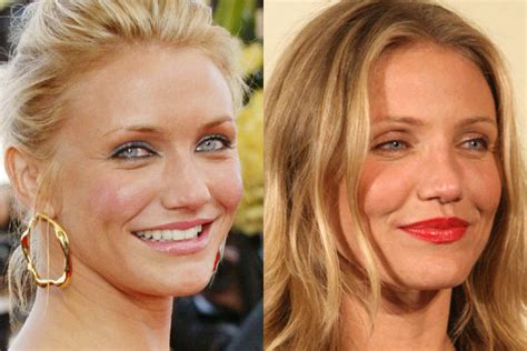 Cameron Diaz Plastic Surgery Before After Breast Implants