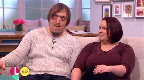 steve and vicky from the undateables have said the