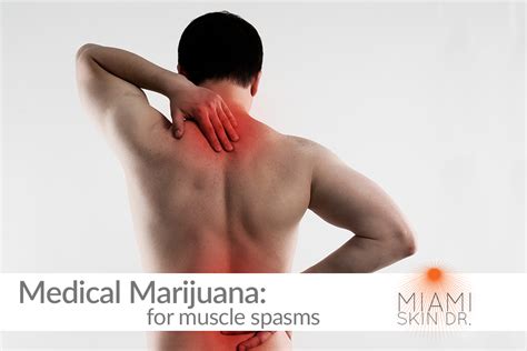 medical cannabis  chronic muscle spasms blog miami skin dr