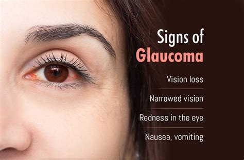 Signs Of Glaucoma