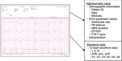 Example Of An Electrocardiogram Ecg Report Alphanumeric Values