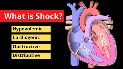 shock explained   seconds treatment symptoms  video youtube