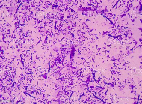 Moderate Bacteria Cells With Gram Stain Method Fide With Microscope