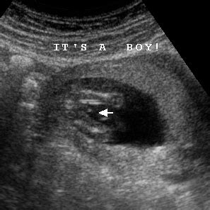 week gender ultrasounds baby child
