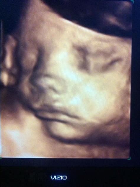 babys image   dd ultrasound studio serving michigan