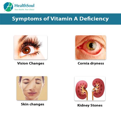 Vitamins Deficiency Diseases Images Vitamins Deficiency Of Disease