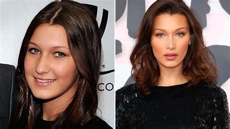 Bella Hadid Says She S Scared Of Cosmetic Surgery I Wouldn T Want