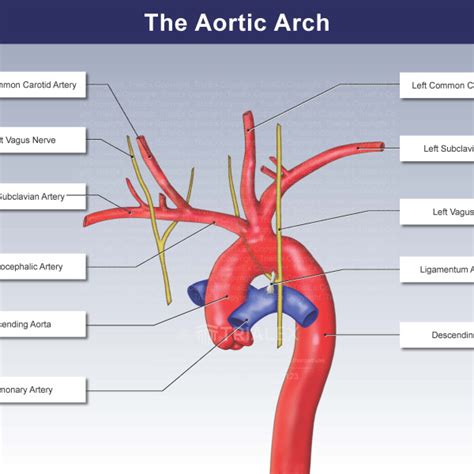 aortic arch trialexhibits