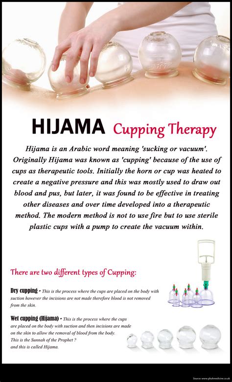 hijama cupping therapy cures critical diseases visual ly
