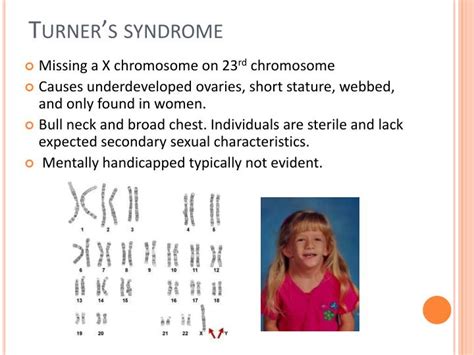 Ppt Karyotype Powerpoint Presentation Id 2171630