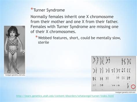 Ppt Genetic Disorders Powerpoint Presentation Free Download Id 2075339