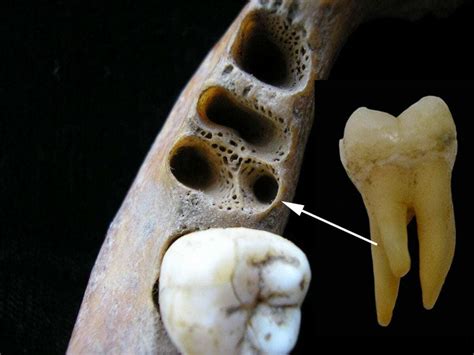 ancient molar points  interbreeding  archaic humans  homo