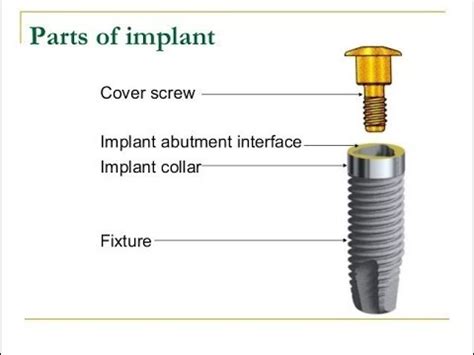 parts  dental implant youtube