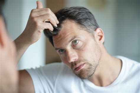 prevent hair loss  ultimate guide hairmd