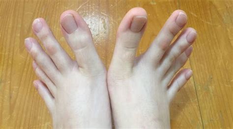 internet s going crazy over this girl who has toes as long as fingers