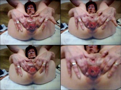 awesome amateur granny big asshole prolapse stretching perverted porn videos