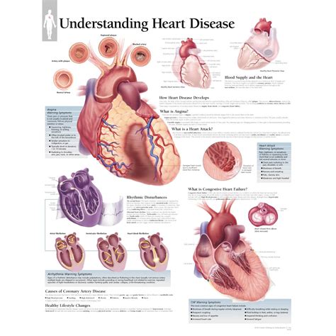 scientific publishing understanding heart disease chart
