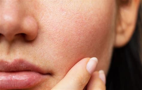 natural ingredients    reduce pores iskincarereviews