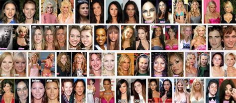 celebrity plastic surgery before and after funtuna