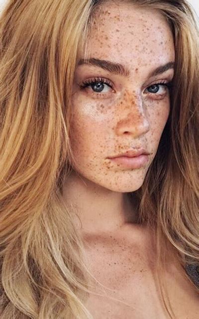 Swantje Paulina Beautiful Freckles Freckles Girl