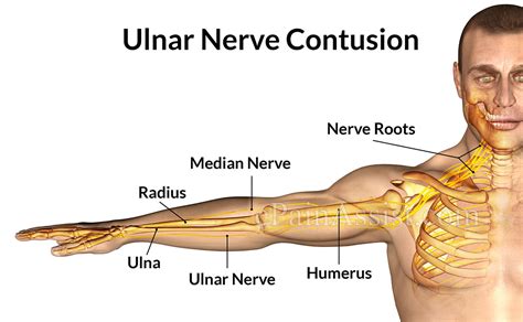 Ulnar Nerve Contusion Symptoms Causes Treatment Cold