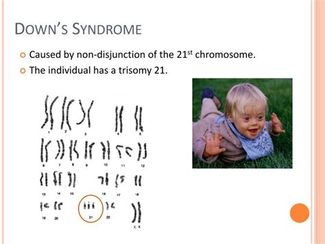 ppt karyotype powerpoint presentation id 2171630